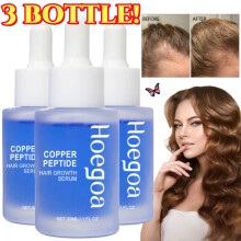 3X Copper Peptide -hiustenkasvuseerumi ravitsee päänahkaa ehkäisee hiustenlähtöä 30ml