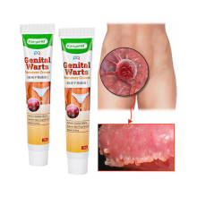 1 pot de crème ou pommade pour l'élimination des verrues génitales, des acrochordons et des grains de beauté (20 g)