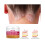 2X Crème voor psoriasis, dermatitis en eczeem. 1