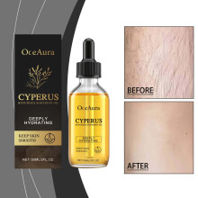 2x Cyperus Rotundus Glättendes Öl, spendet intensive Feuchtigkeit, hält die Haut geschmeidig