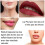 Ομορφιά - Wellness NOT Lip Plumper 600mAh 2 Ανταλλακτικές Κεφαλές Γεμίσματος Χειλιών Εργα 5