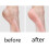 10 coltelli per pedicure per rimuovere calli e pelle morta 6