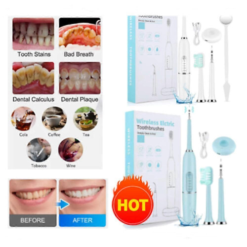 (basic version, white) Electric Tooth Cleaner Ultrasonic Dental Scaler Tartar Plaque Calculus Remover~