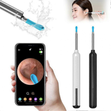 (Negro) Otoscopio inteligente inalámbrico, limpiador visual de oídos, kit de herramientas para la eliminación de cerumen con luz, endoscopio
