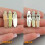 Bedste Venner Broche Nåle Sæt – 5Sisters Design 5