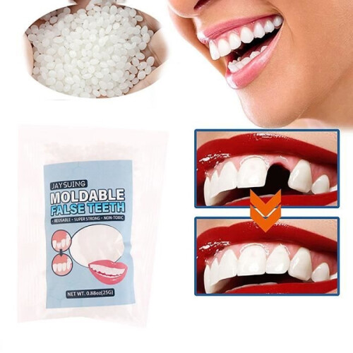 Temporary Resin Tooth Repair Kit, False Teeth, Strong Glue, Denture Adhesive - One Size[E9] 2
