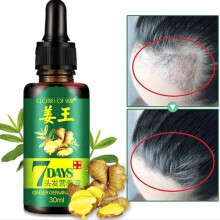 Anti Hair Loss, Hair Growth Serum, Natural Herbal Hair Growth Serum, Help Hair Growth