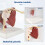 Human Skeleton Shoulder Scapula Clavicle Muscle Joint Functional Ligament Teaching Aid Model 5