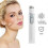 Blue light laser pen for spider vein and wrinkle removal 2