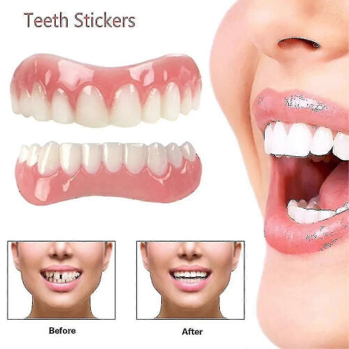 Bright White Silicone Tooth Veneers - Extra Thin & Comfortable Fake Teeth Cover 1