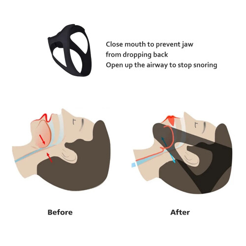 Anti Snoring Chin Strap - Stop Snoring with Adjustable Snoring Belt_Surprise Gift 1