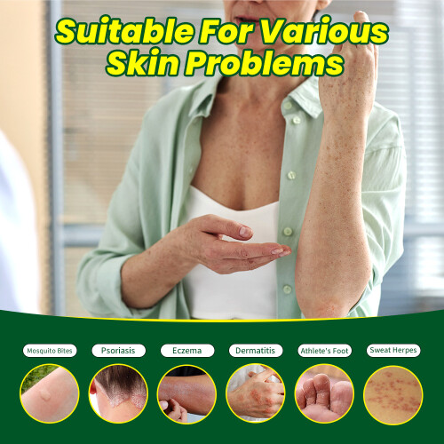 Creme de cuidados com a pele corporal Herbal Skin Balm 1