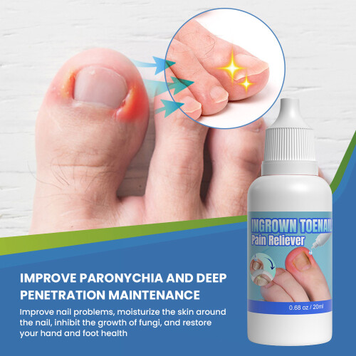 Jiagoukang Care Solution Solução para cuidados com onicomicose 2