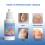 Jiagoukang Care Solution Solução para cuidados com onicomicose 5
