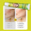 Gel de limão para pele, bálsamo para cuidados com acne 5