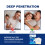 Emplastro de próstata para saúde masculina 4