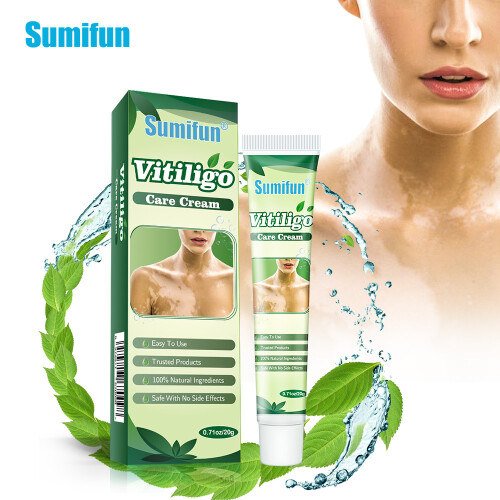 Creme para manchas brancas, manchas de suor e cuidados com sardas e creme de saúde