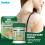 Creme para manchas brancas creme para cuidados com a pele 1