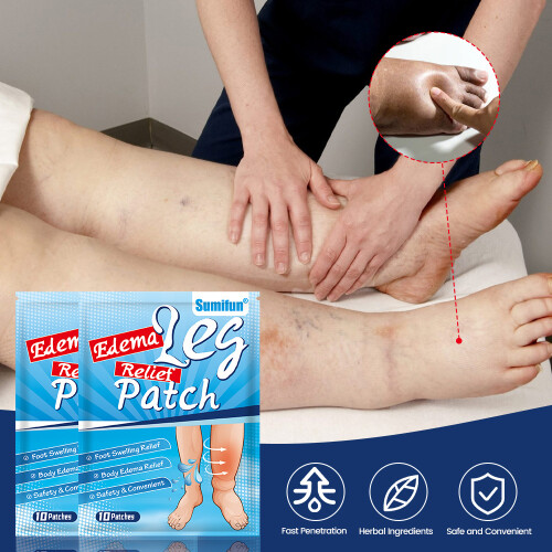 Patch de edema para cuidados com os pés e edema nas pernas 1