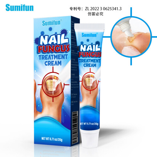 Creme de saúde para onicomicose Creme para esmalte 1
