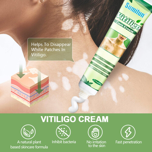 Creme para manchas brancas, manchas de suor e cuidados com sardas e creme de saúde 1