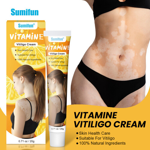 Creme para cuidados com manchas brancas de vitiligo vitamina E