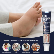 Creme para Edema, Creme de Dragagem para Saúde, Massagem para Edema nas Pernas