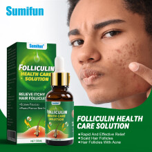 Solução para cuidados de saúde do folículo capilar, essência de reparo da pele, solução para cuidados com a pele
