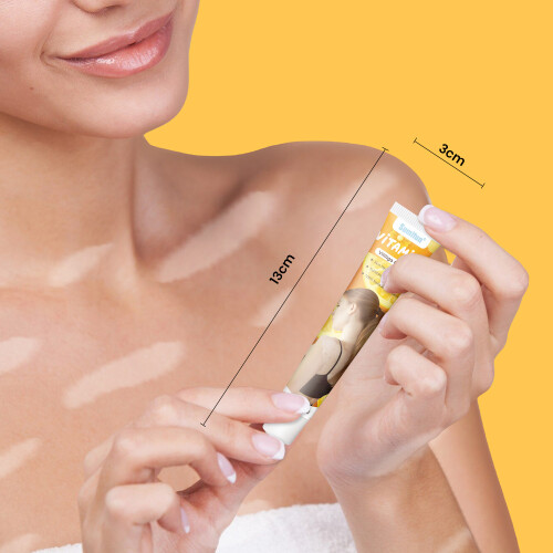 Creme para cuidados com manchas brancas de vitiligo vitamina E 2