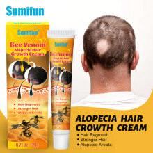(B) Conjunto de cremes Alopecia Areata Creme Nutricional para Cuidados de Saúde do Couro Cabeludo