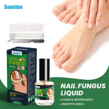 Líquido para onicomicose, líquido para remoção de unhas pretas e reparo para manicure