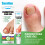 Jiagoukang Creme Xinliang Unhas Onicomicose Creme para Cuidados com as Unhas 1