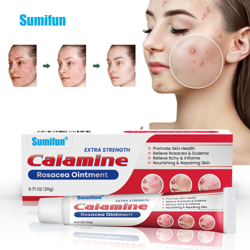 Creme para acne Creme para cuidados com a pele de calamina 1