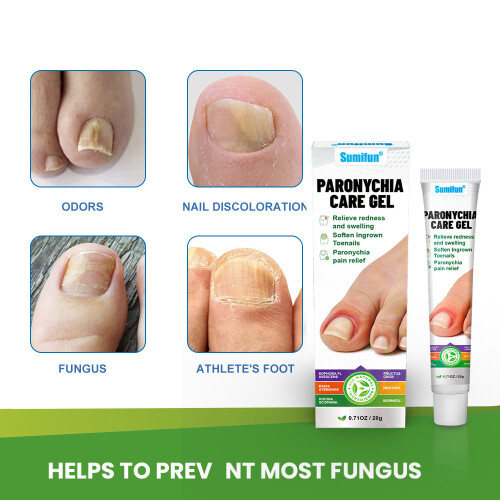 Jiagoukang Creme Xinliang Unhas Onicomicose Creme para Cuidados com as Unhas 1