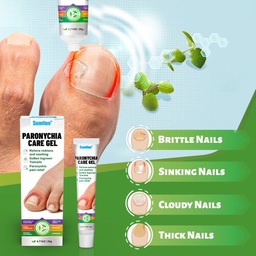 Jiagoukang Creme Xinliang Unhas Onicomicose Creme para Cuidados com as Unhas 2