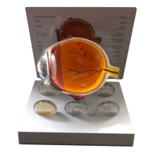 Eyeball Model Human Eye Demonstration Glaucoma Cataract Anatomy Medical Teaching Tool Eyeball Lesion Model