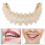 Smile dentures, upper and lower dental veneers-DG 1