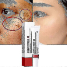 (1pcs) Cream To Remove Melasma And Melanin - 2023 Skin Care By Changzhao - In S And L Sizes Tw