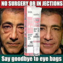2025 Instant eye bag removal cream retinol anti-wrinkle firming skin lightens fine lines fast anti-dark circles puffiness brightens eyes