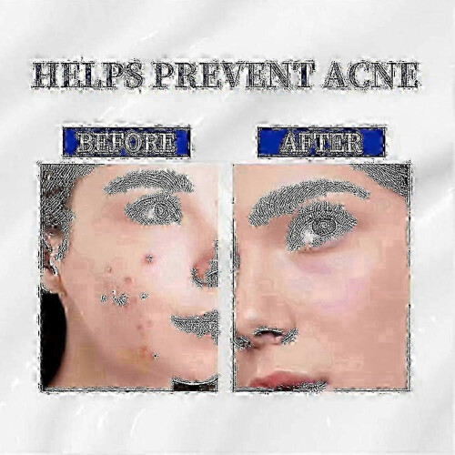(3pcs) A~313 Retinol Cream: The Ultimate Solution for Face, Combating Aging, Pores & Skin Issues 1