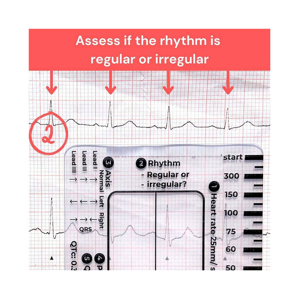 5X ECG 7 Step Ruler, ECG 7 Step Ruler for ECG/EKG Interpretation, Rapid and Quick Cardiac Analysis and Measurement Tool