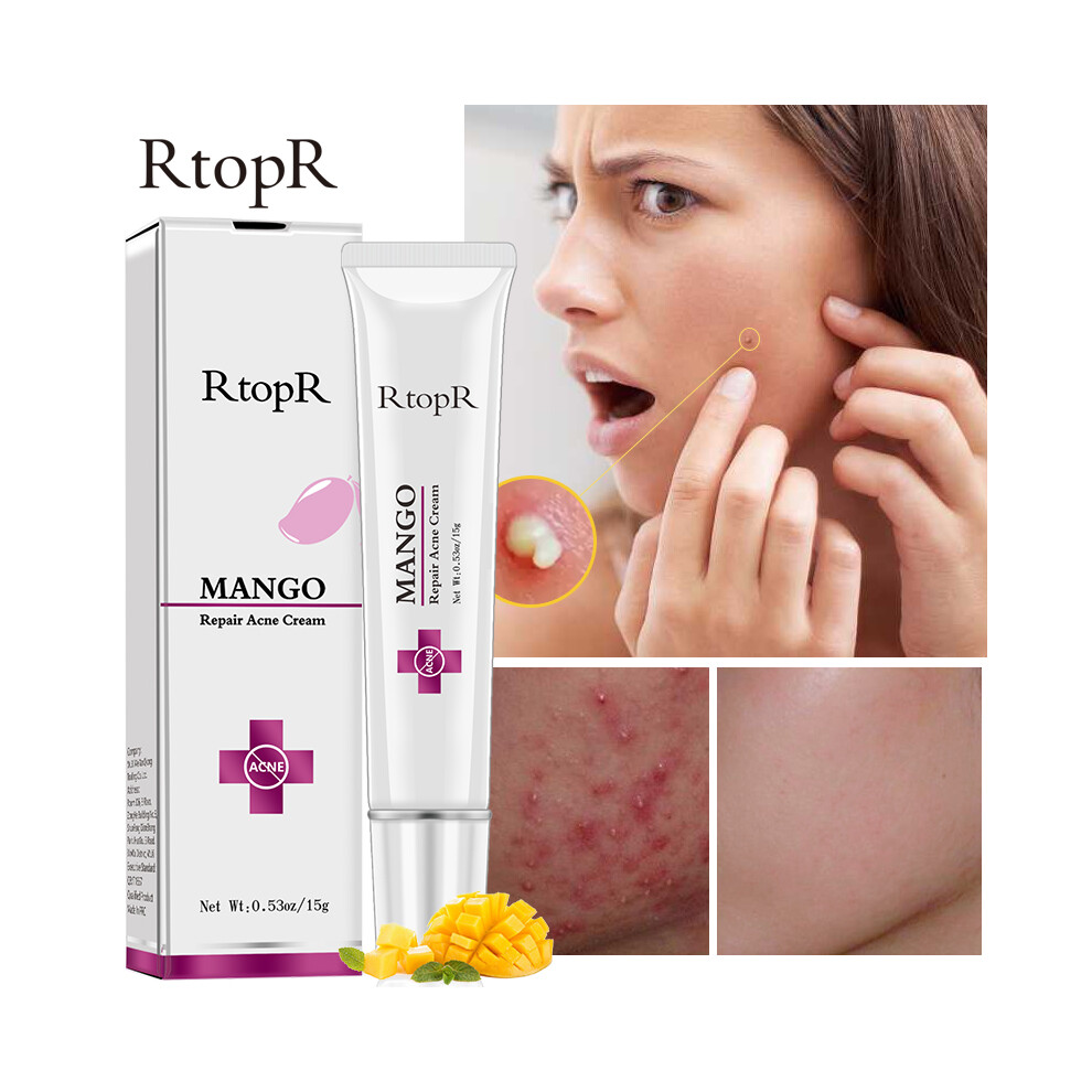 Rtopr Mango Acne Repair Oil Control Pore Shrinking Whitening Moisturizing Skin Care Cream 110691498144