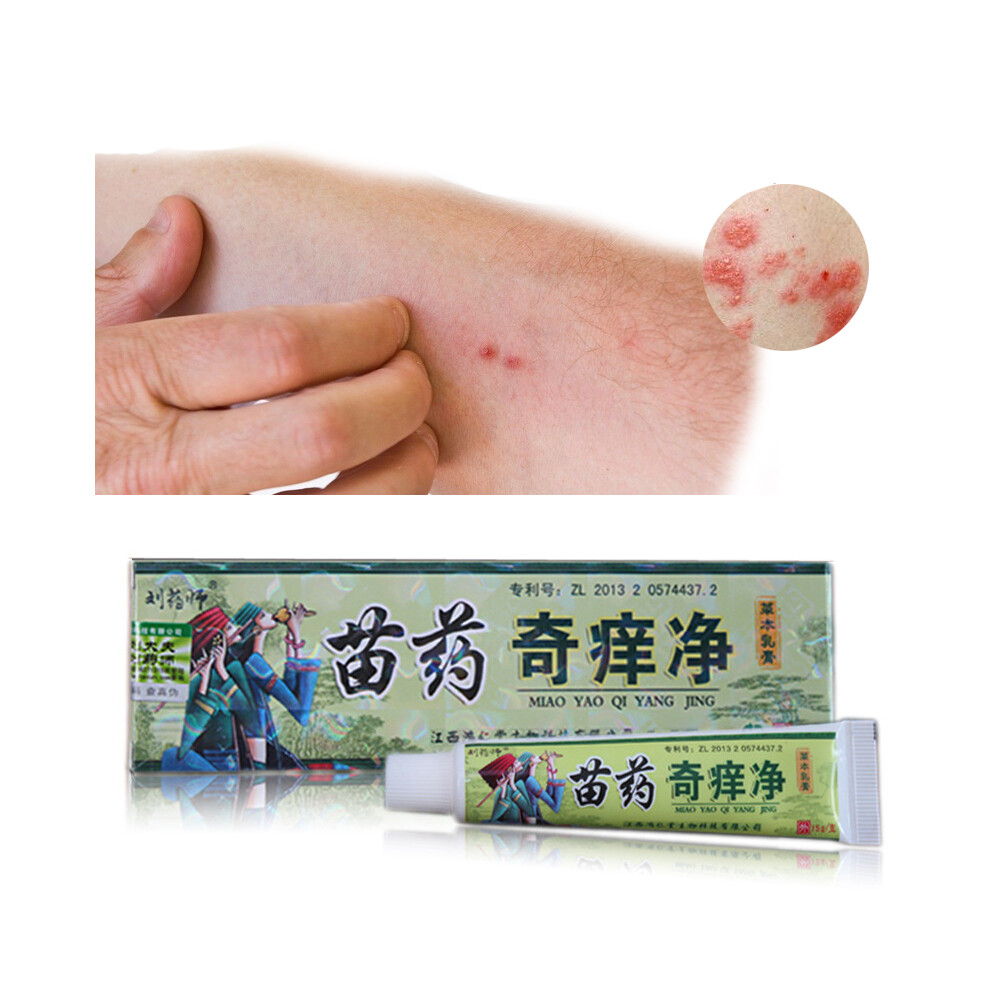 Cream Body Health Psoriasis Dermatitis Eczema Pruritus Psoriasis Ointment Skin Care
