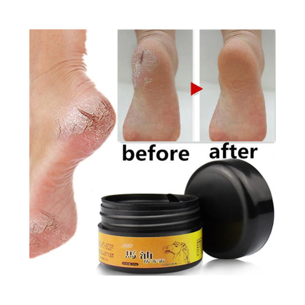 Cream Horse Oil Feet Care Athlete's Foot Itch Blisters Peeling Ointment