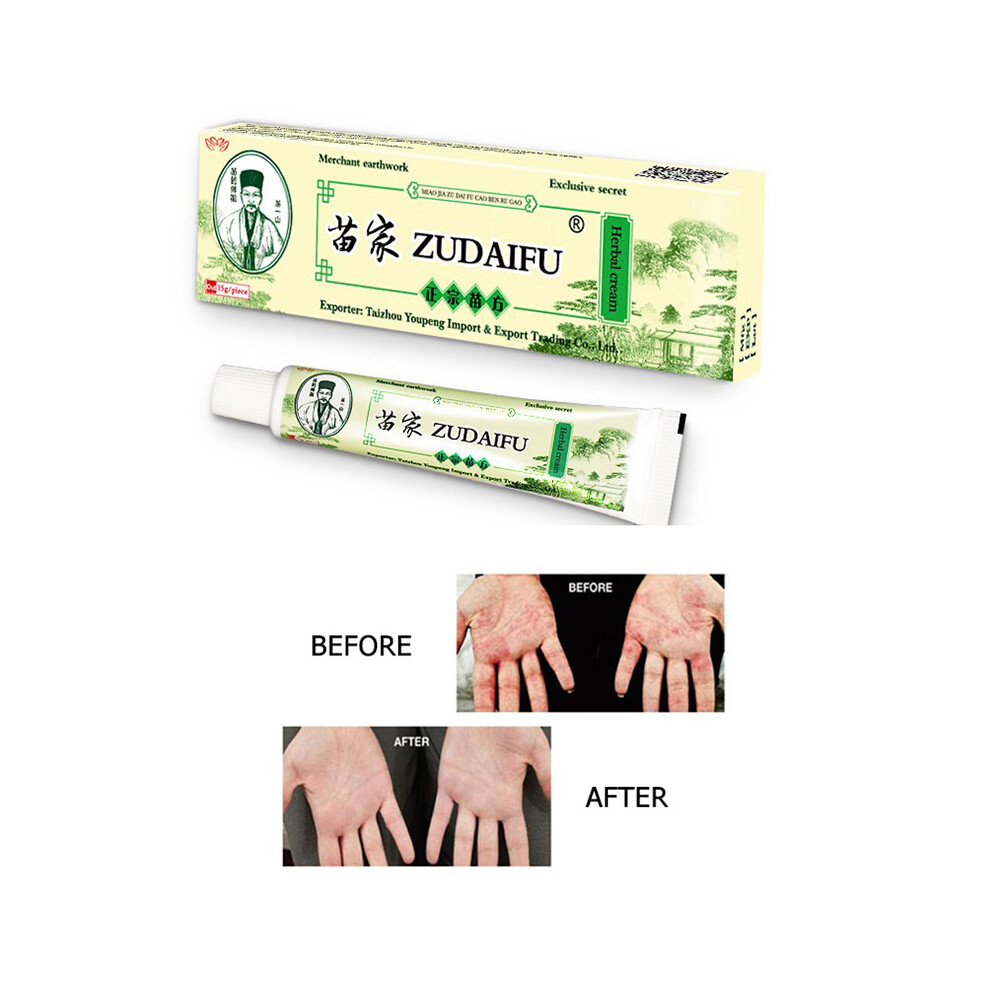 Cream Psoriasis Skin Dermatitis Eczema Eczema Ointment Treatment Psoriasis Skin Care Chinese And English Face 15G