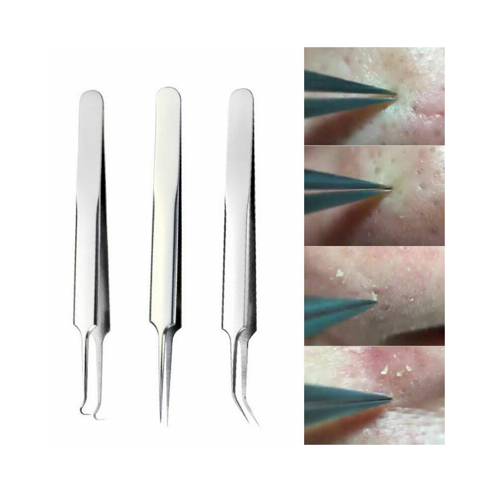 Blackhead Remover Acne Tool Professional Stainless Steel Curved Pimple Tweezers Comedone Extractor