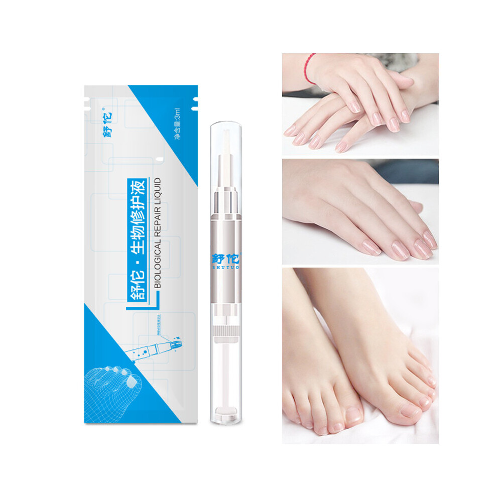 3ML Anti-Fungal Nail Pen Onychomycosis Paronychia Herbal Toe Finger Health Care