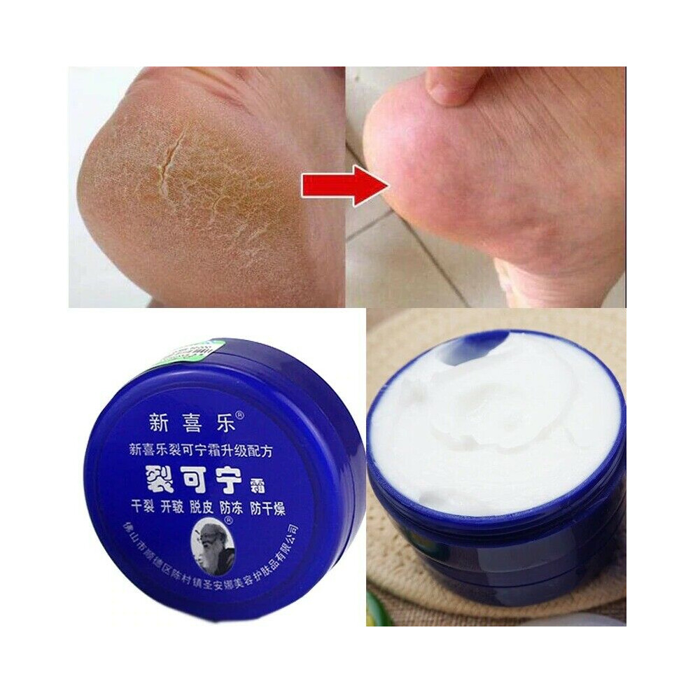 Cream Oil Anti-Drying Crack Foot Heel Cracked Repair Removal Dead Skin