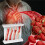 LDL Cholesterol Blood Vessel Model, 4-Stage Vascular Disease Teaching and Training Tool 6