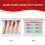 LDL Cholesterol Blood Vessel Model, 4-Stage Vascular Disease Teaching and Training Tool 3
